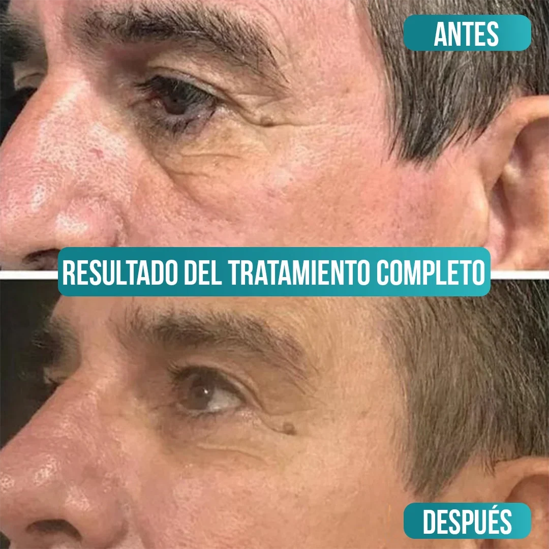 Veze Men - Crema Antiedad para Hombres - Compra 1 y llévate 2